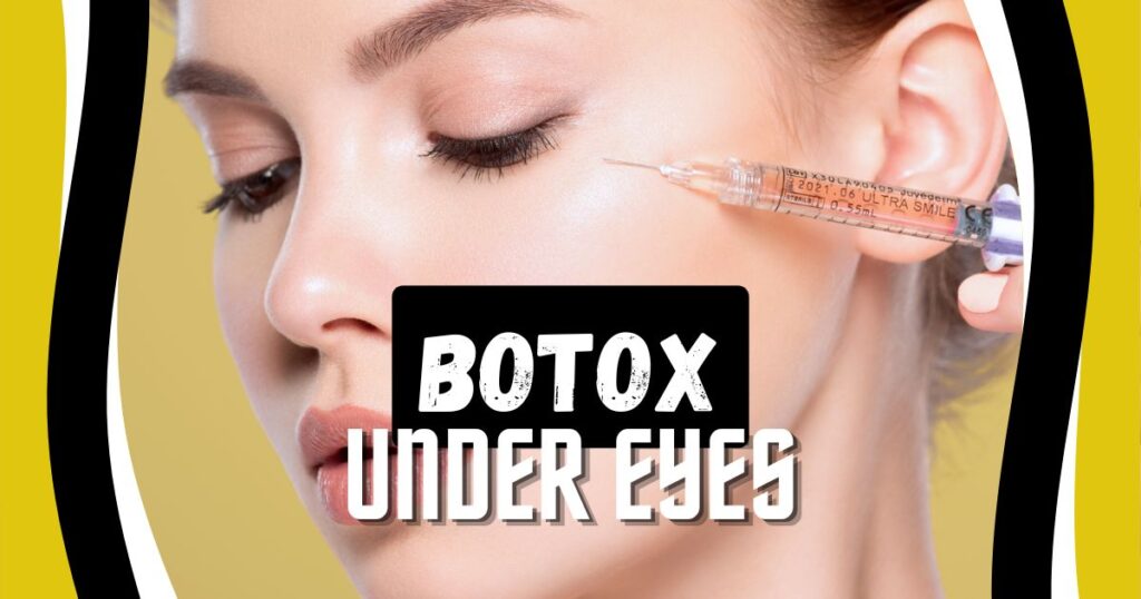 Read more about the article Is Botox Under Eyes the Secret to Youthful Skin? Discover the TruthWhat is Botox Under Eyes?