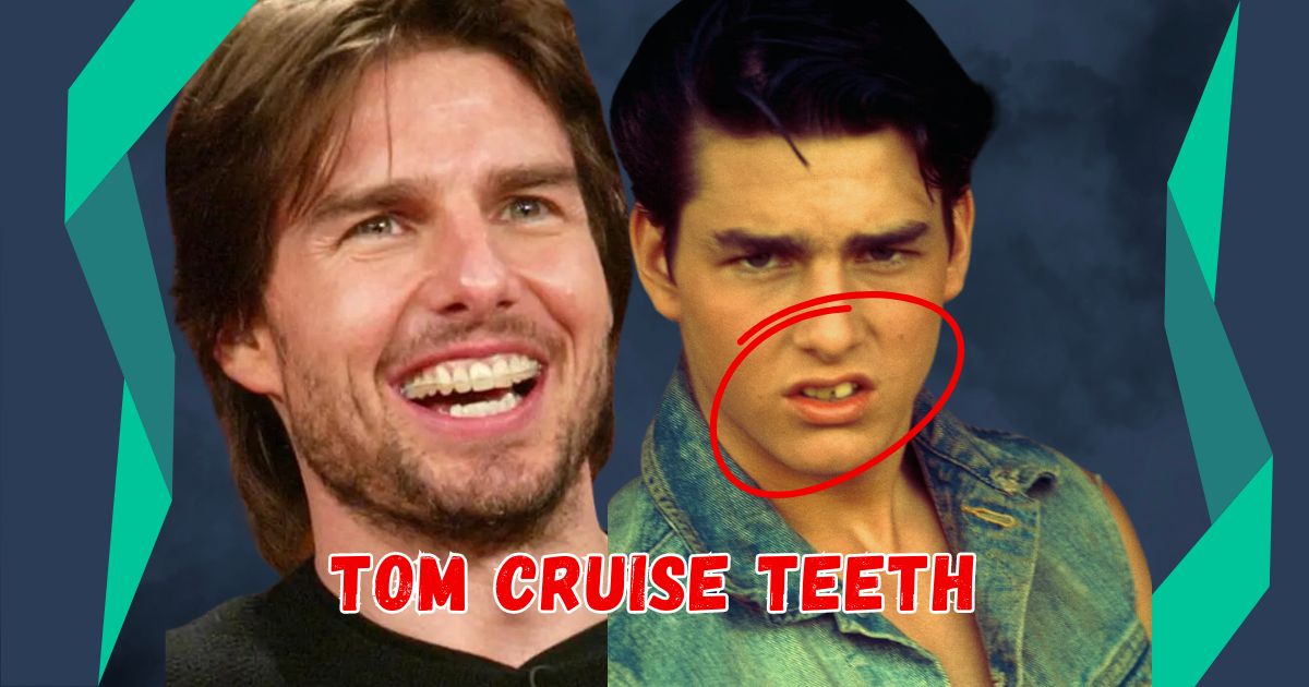 Tom Cruise Teeth