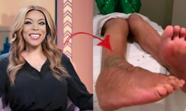 5 Surprising Facts About Wendy Williams Feet and Health Journey