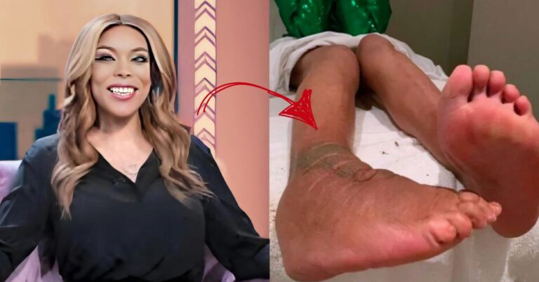 Read more about the article 5 Surprising Facts About Wendy Williams Feet and Health Journey