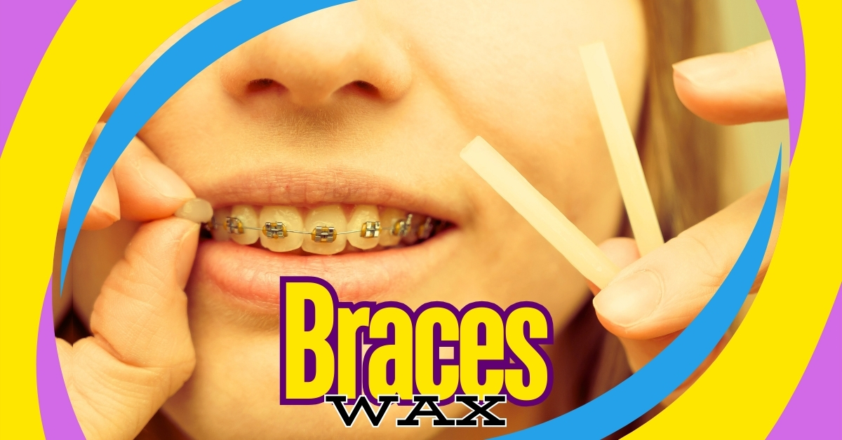 braces wax