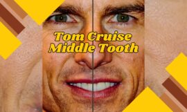 5 Fascinating Facts About Tom Cruise Middle Tooth