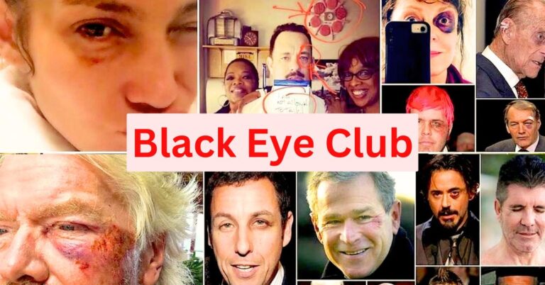 Black Eye Club